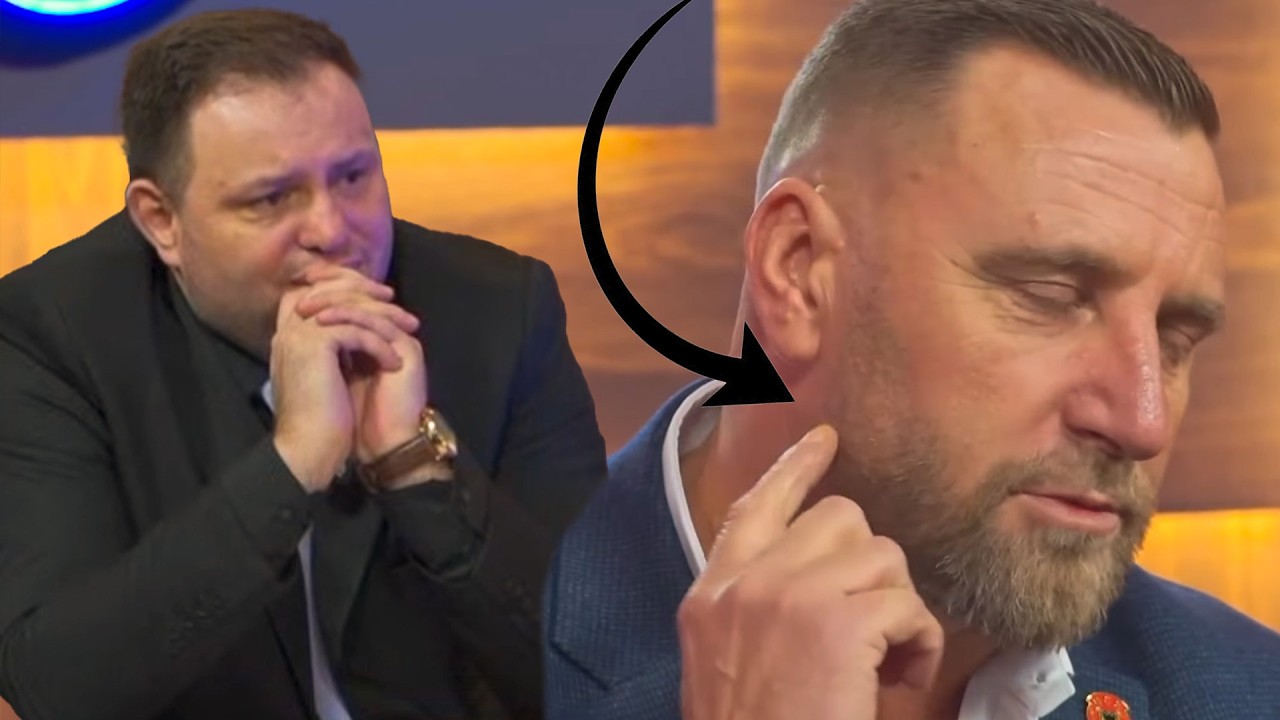 E dhimbshme: Ushtari i UCK se zbulon 18 plagët ne trup. Shikojeni çka i bënë paramilitarët Serb