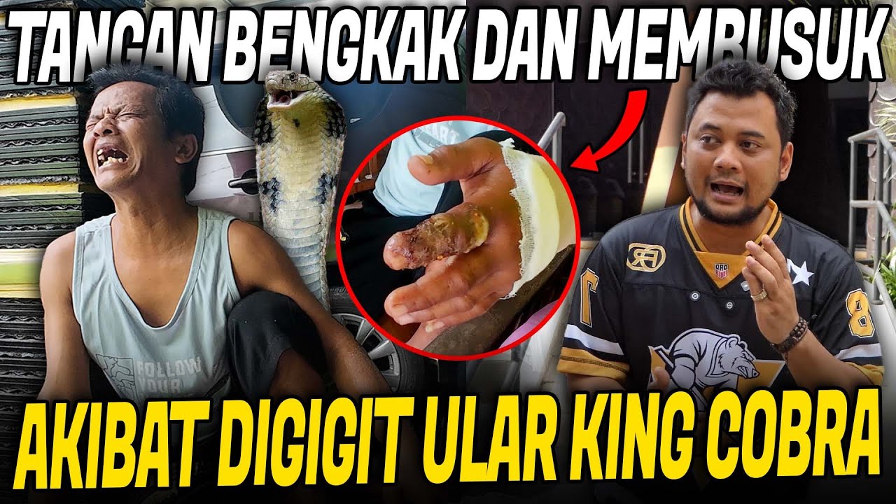 DIGIGIT KING COBRA BESAR !! BAPAK INI LANGSUNG MINTA DIOBATI !!