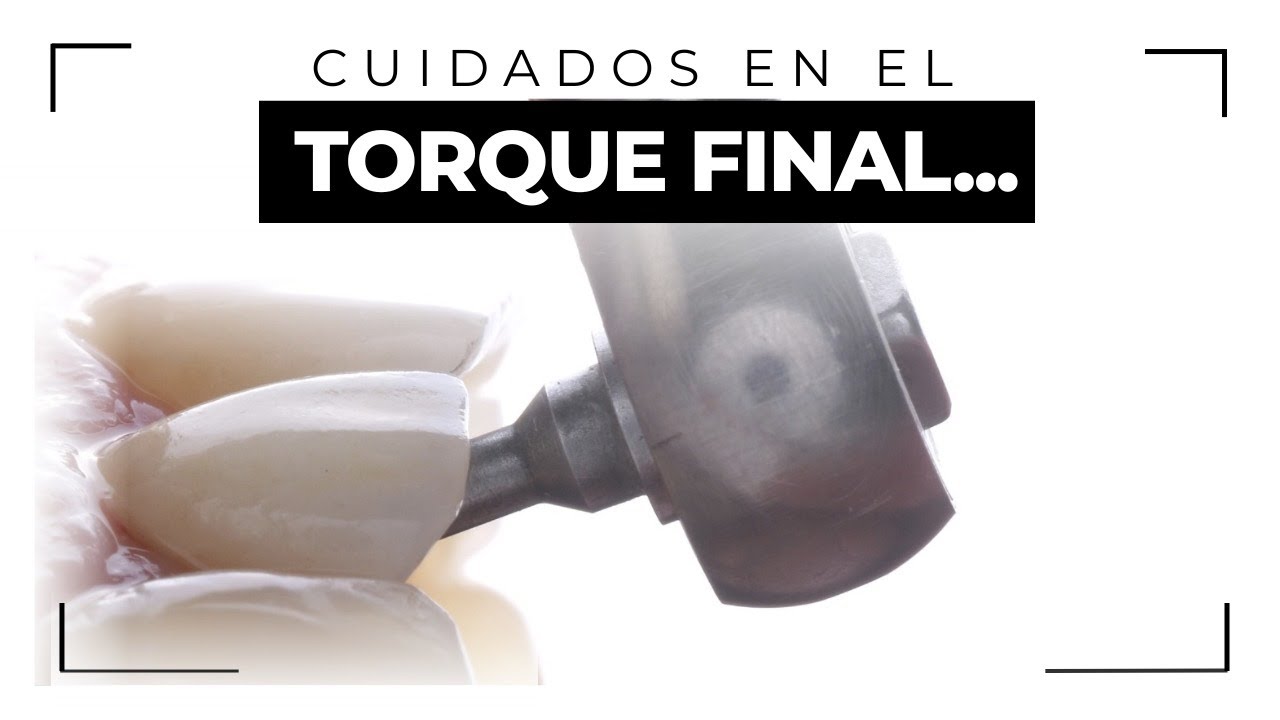 Cuidados en el torque final... | Milko Villarroel con Armando Badet