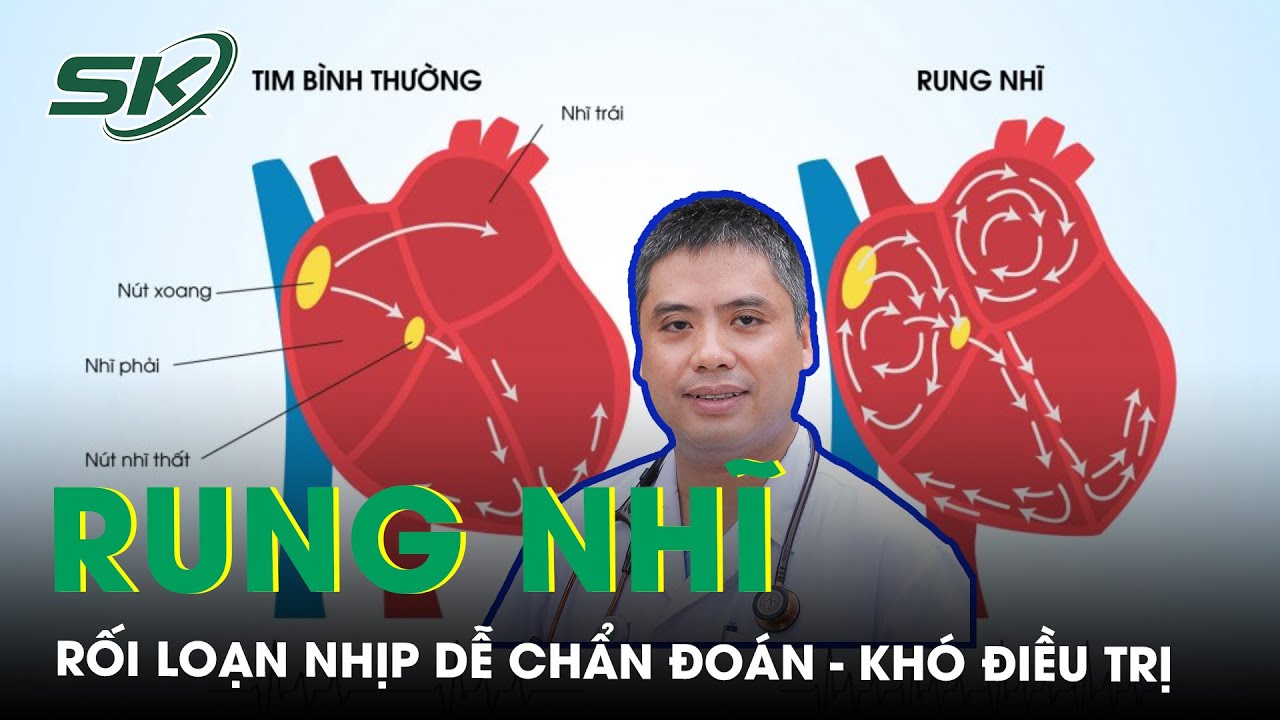 Rung Nhĩ: Rối Loạn Nhịp Dễ Chẩn Đoán – Khó Điều Trị | SKĐS