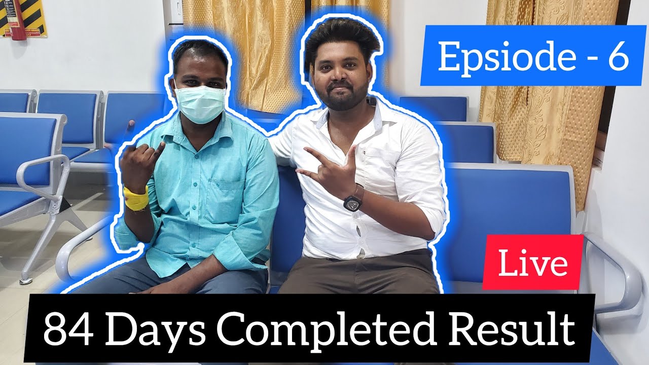 Episode-6 83Days Hair Transplant Result || FUE Tamil Hair Transplant | Tamilan HT