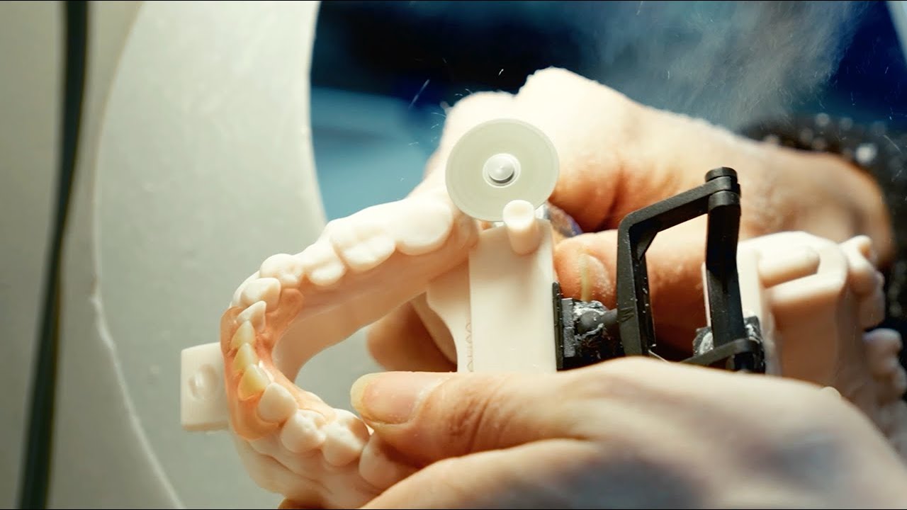 How Absolute Dental Is Leading the Future of Flexible Partials with FP3D™