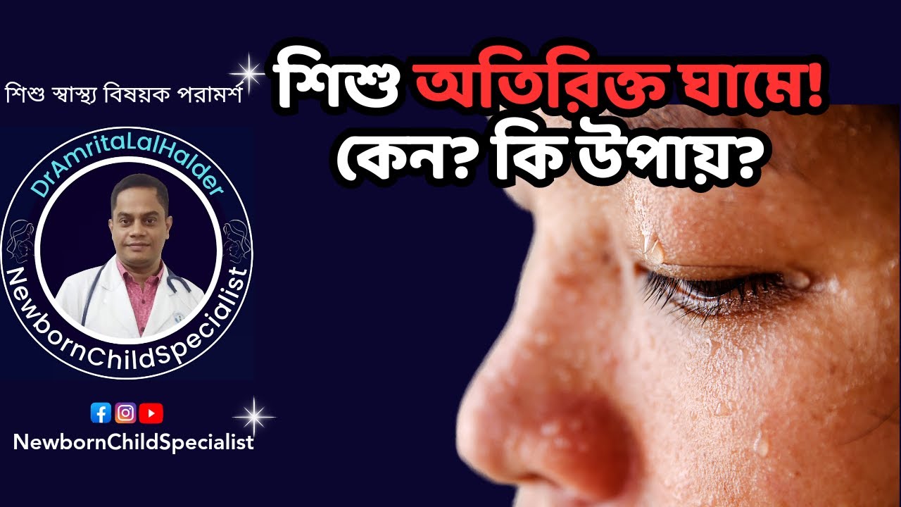 বাচ্চা প্রচুর ঘামে। শিশুদের অতিরিক্ত ঘামার কারণ। DrAmritaLalHalder. ChildSpecialist.