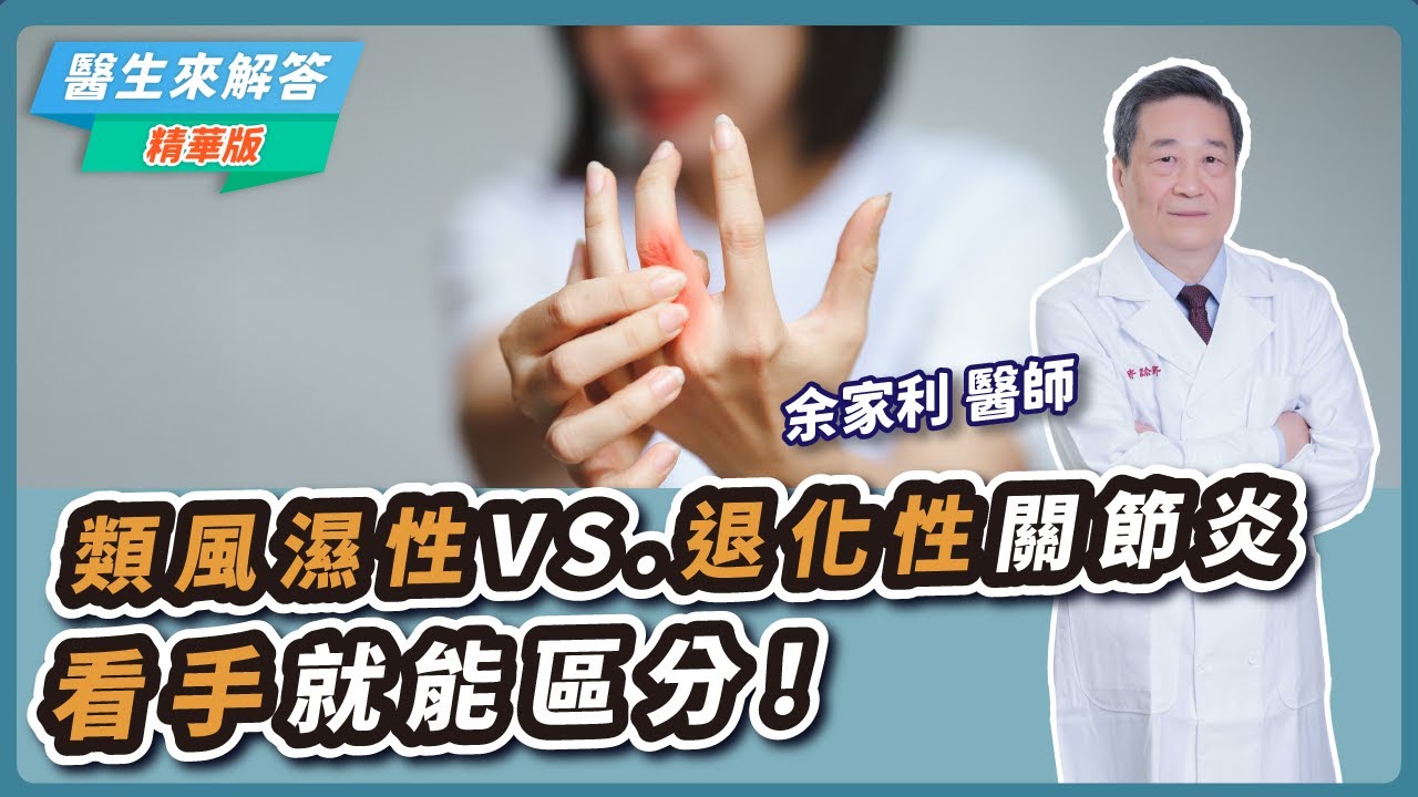 【醫生來解答－聽醫生的話@icare愛健康】類風濕性VS.退化性關節炎 看手就能區分！｜專訪：余家利 醫師