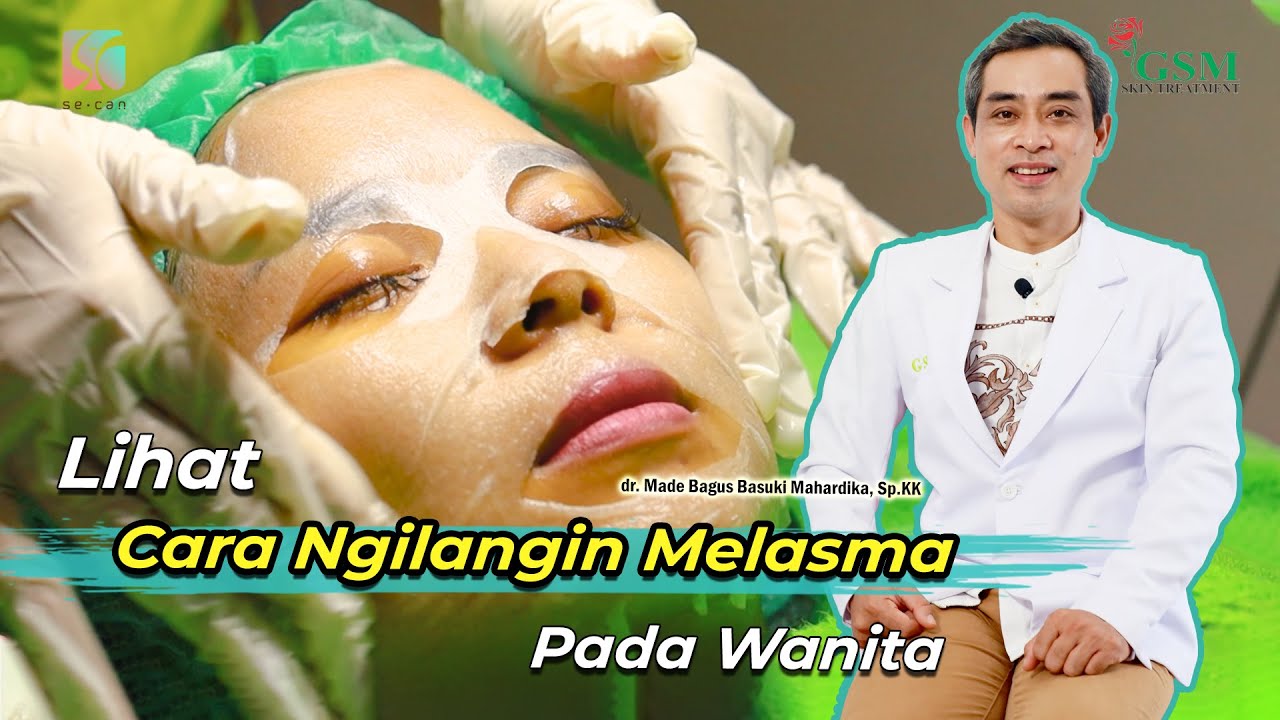 Cara Tepat Menghilangkan Melasma pada Kulit Wanita