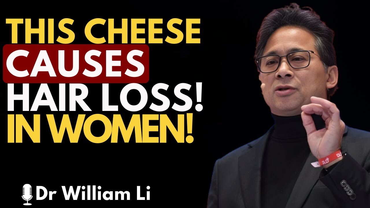 Avoid This Cheese or Lose Hair Fast   Dr William Li