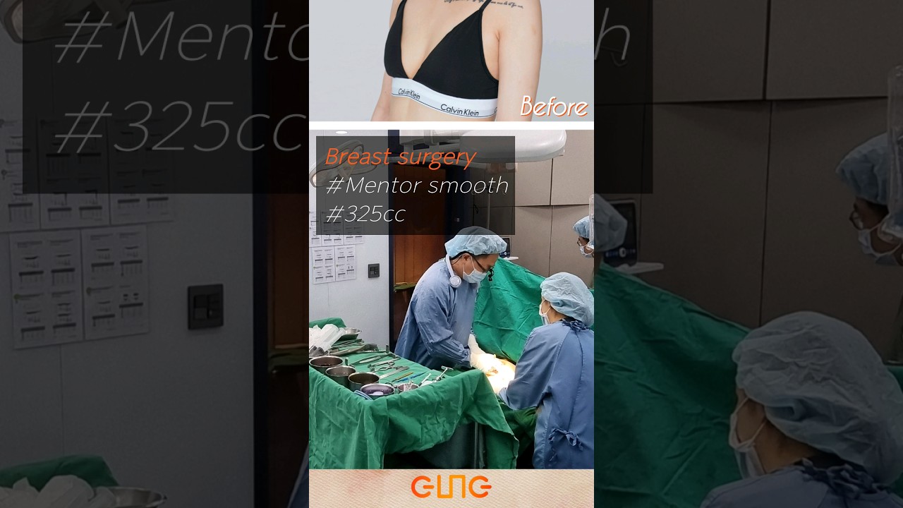 Breast surgery #korea