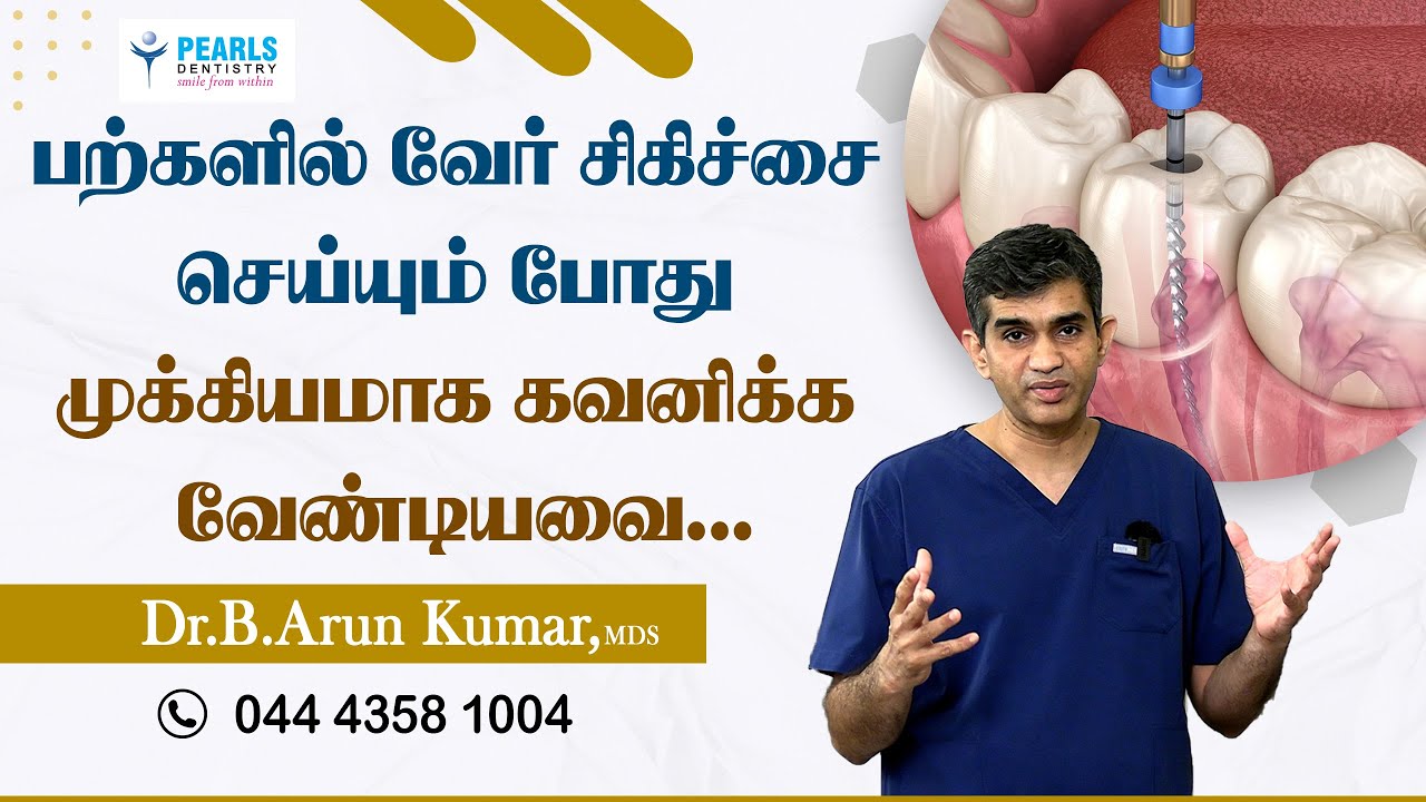 பற்களில் வேர் சிகிச்சை செய்யும் போது முக்கியமாக கவனிக்க வேண்டியவை.!- Pearls Dentistry-Dr. Arun Kumar