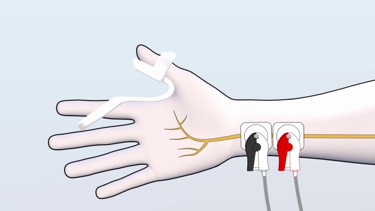 How to set up the ToFscan Adult Thumb Sensor