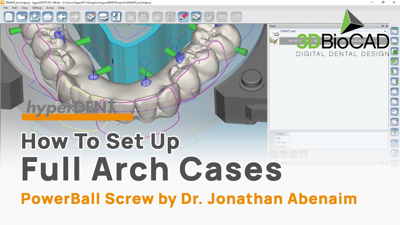 How To Set Up Full Arch Zirconia Cases With PowerBall Screw l FOLLOW-ME! hyperDENT l 3DBioCAD