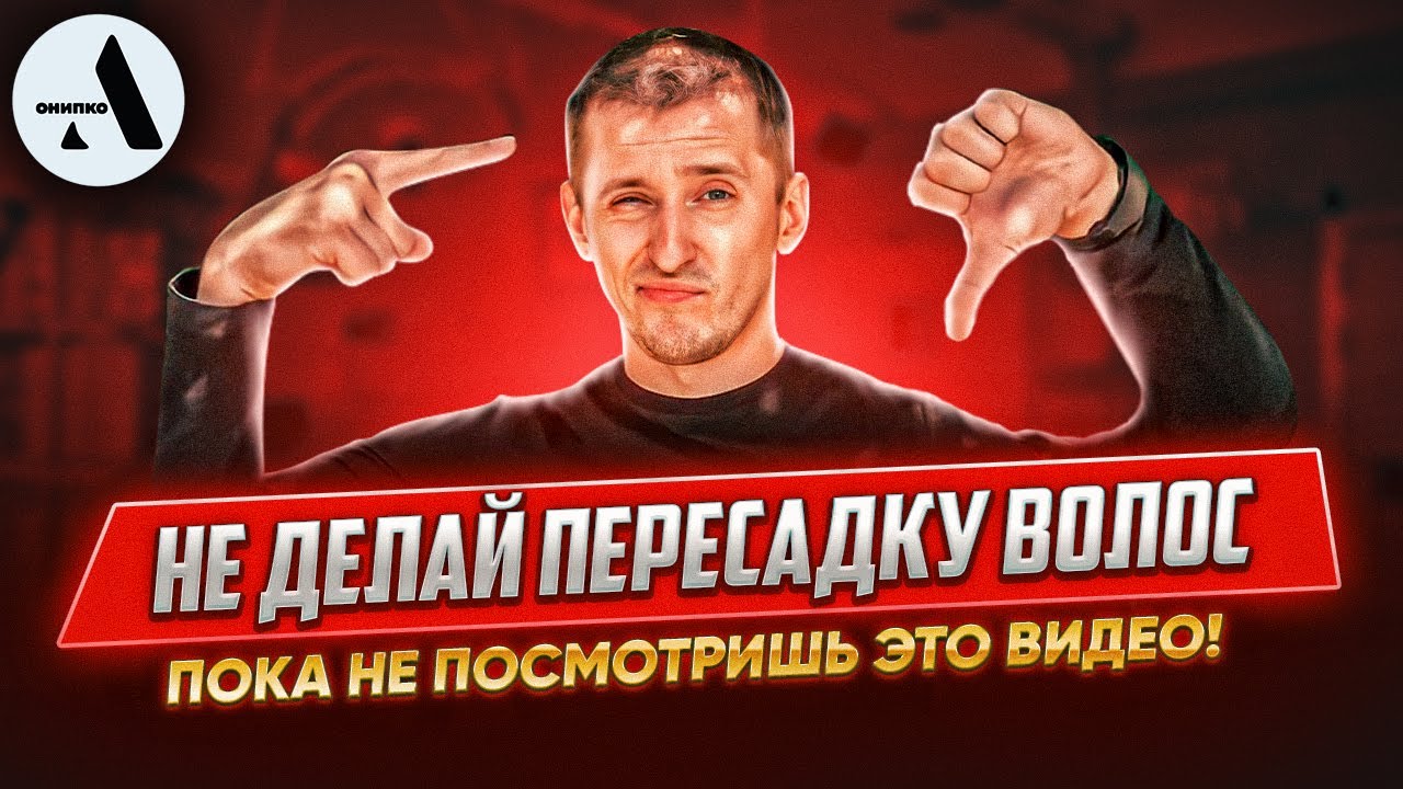 Всё что нужно знать о пересадке волос в 2025 году!