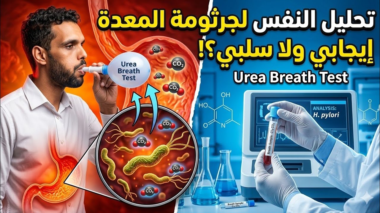 تحليل جرثومة المعدة في النفس (اختبار تنفس اليوريا) urea breath test 🫁