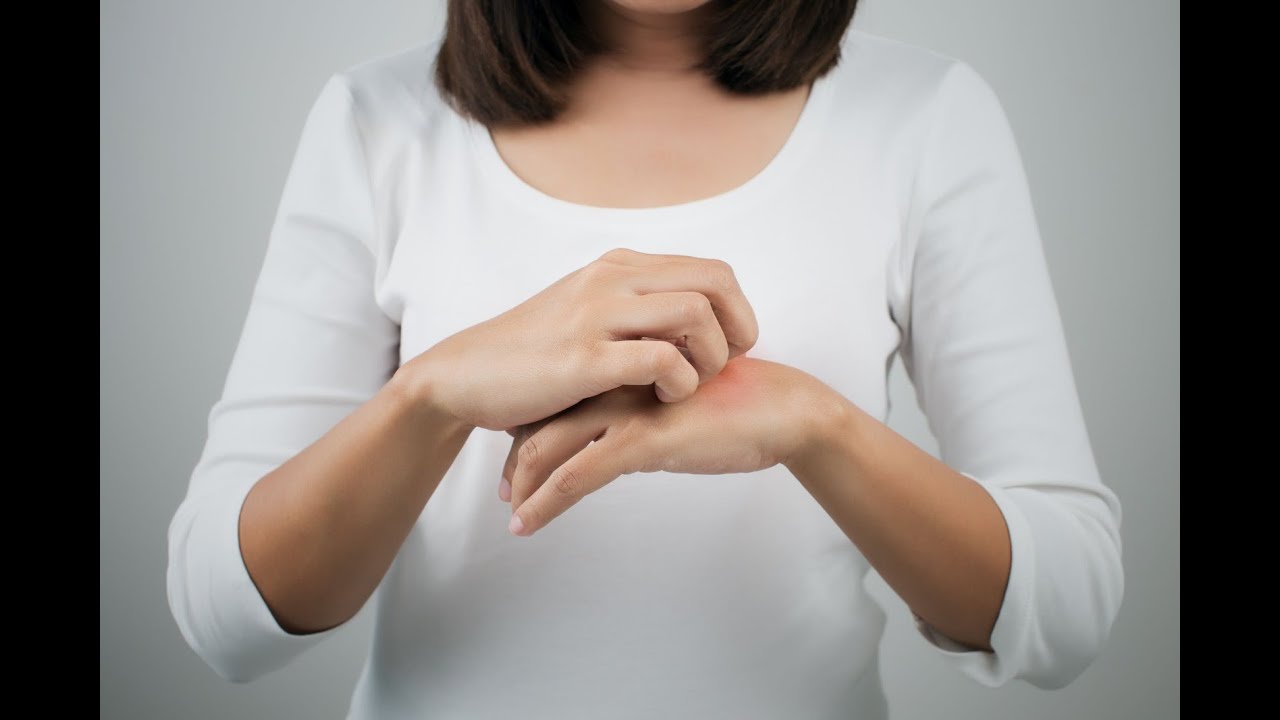 Tutto sulla dermatite atopica