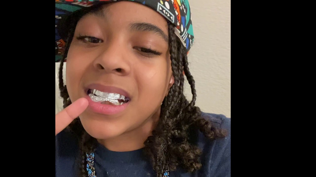 How to fake African American accent with drip & fake teeth..