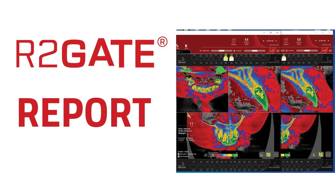 R2Gate Report Usage and interpretation