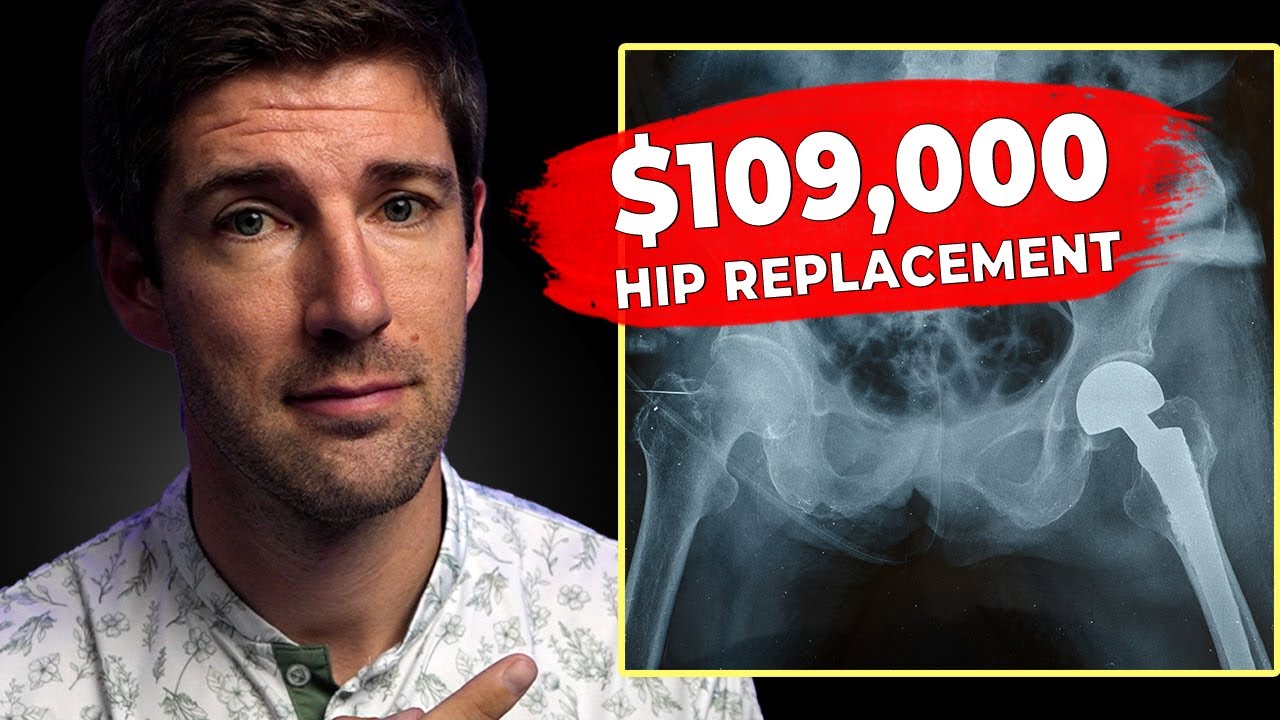 How Much a $109,000 Hip Replacement Ends Up Costing You on Medicare vs ACA 💰