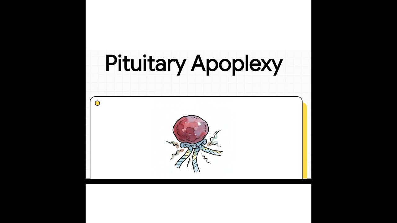 Pituitary Apoplexy | Emergency Recognition, Imaging Pearls & Acute Management