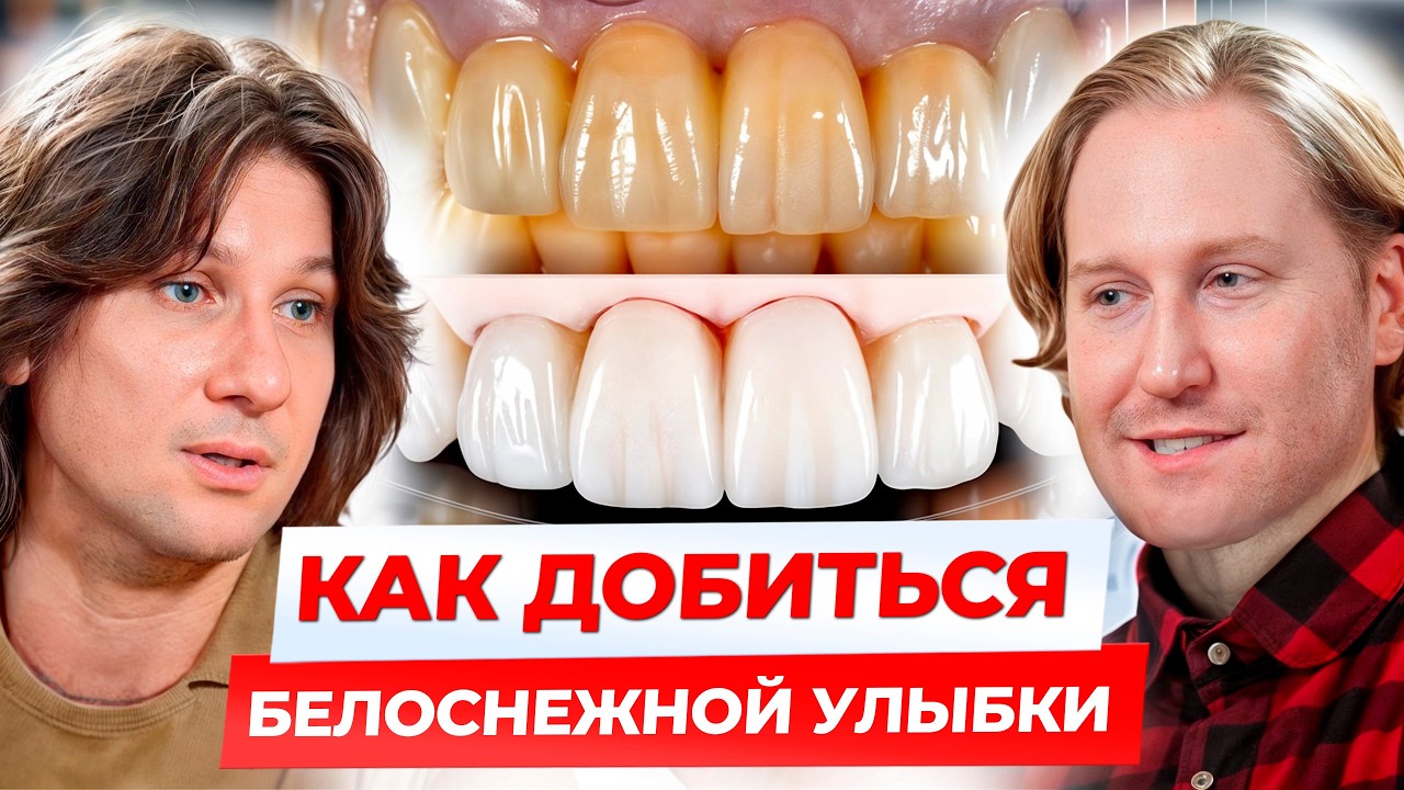 БЕЛЫЕ зубы БЕЗ вреда для здоровья! / Стоит ли устанавливать виниры?