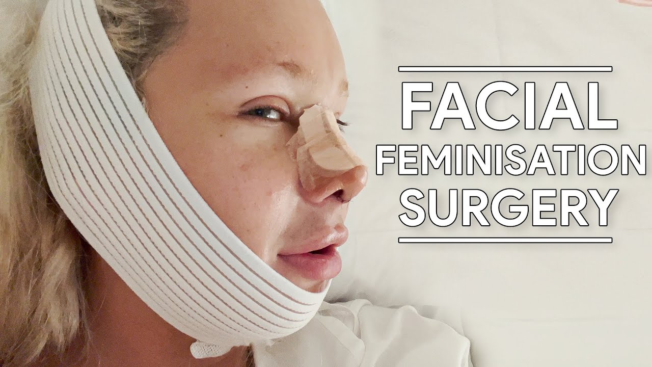 I had Facial Feminisation Surgery (with Facialteam)