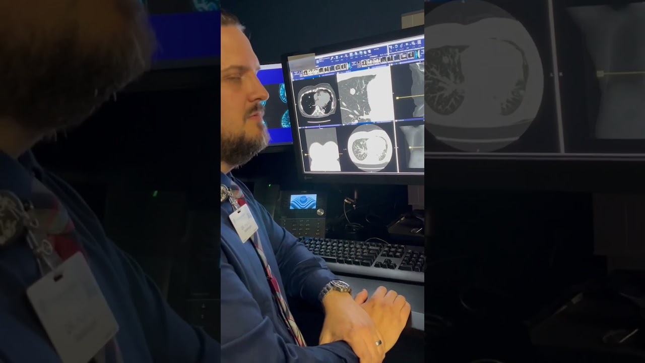 Learn what our Radiologists look for in a lung cancer screening CT.