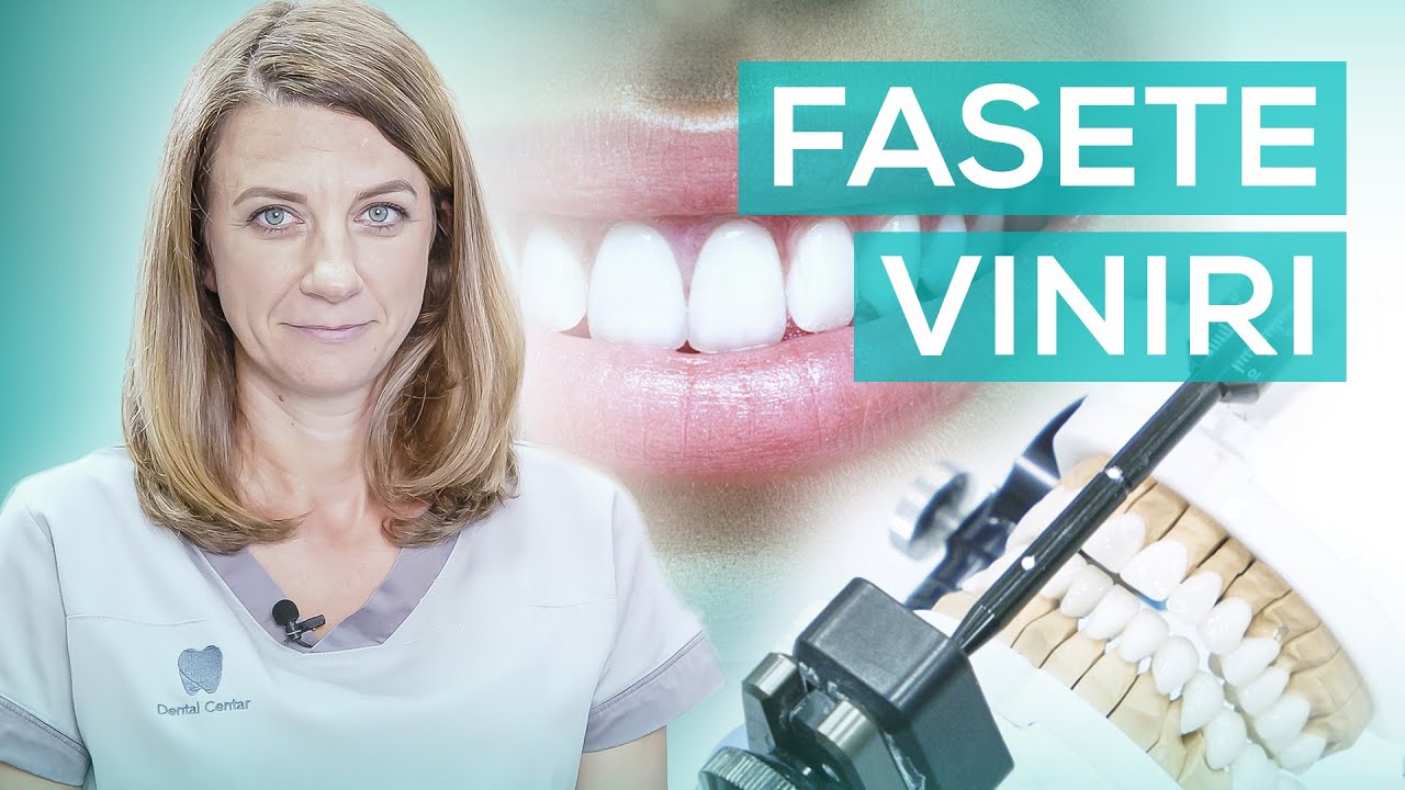 Keramičke fasete | Dental Centar Bobić - Novi Sad, Srbija