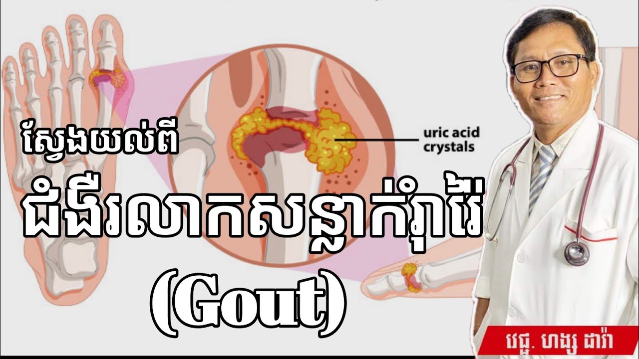 ស្វែងយល់ពី ជំងឺរលាកសន្លាក់រ៉ាំរ៉ៃ (Gout) | វេជ្ជ. ហង្ស ដារ៉ា | success knowledge