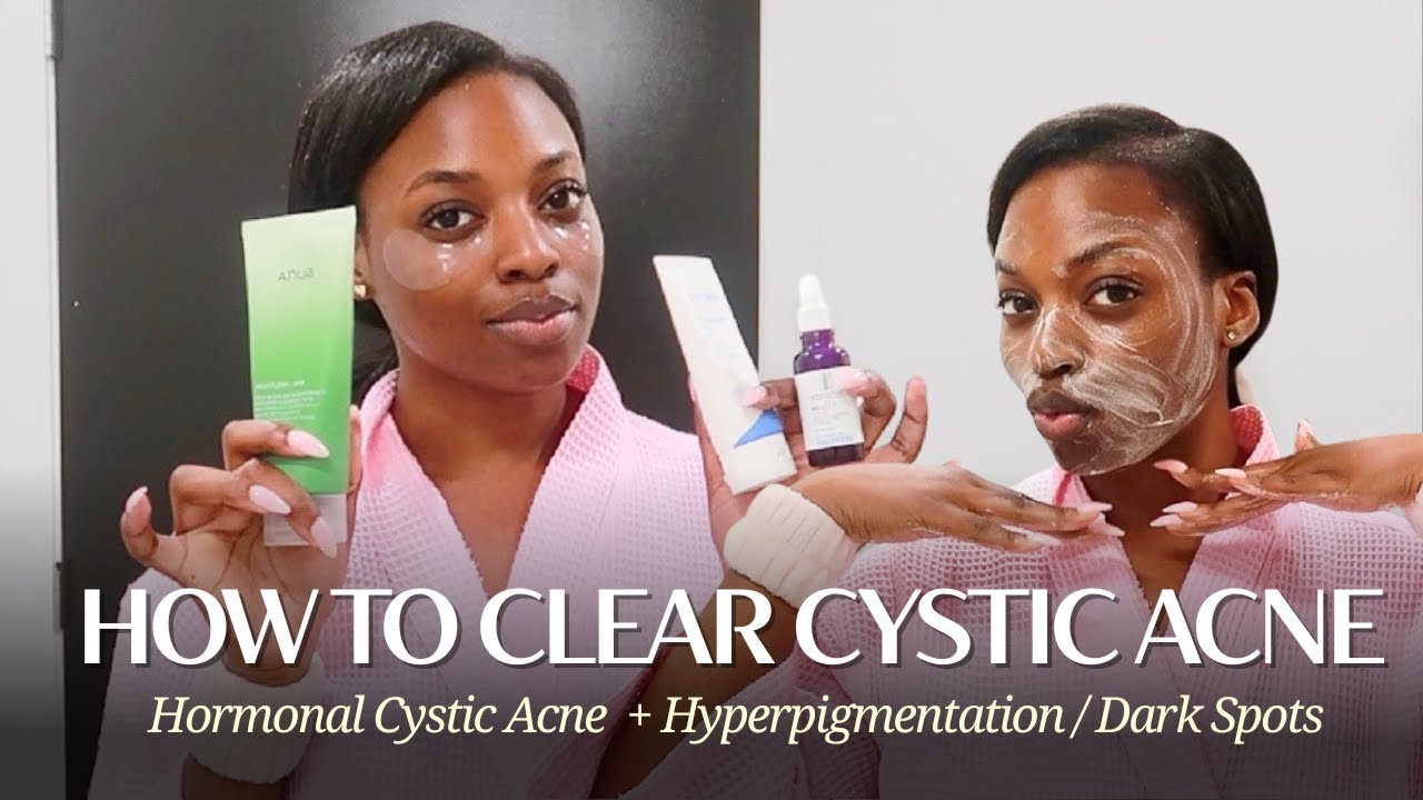 How I Clear My Hormonal/Cystic Acne | PCOS Skincare Routine #skincareroutine