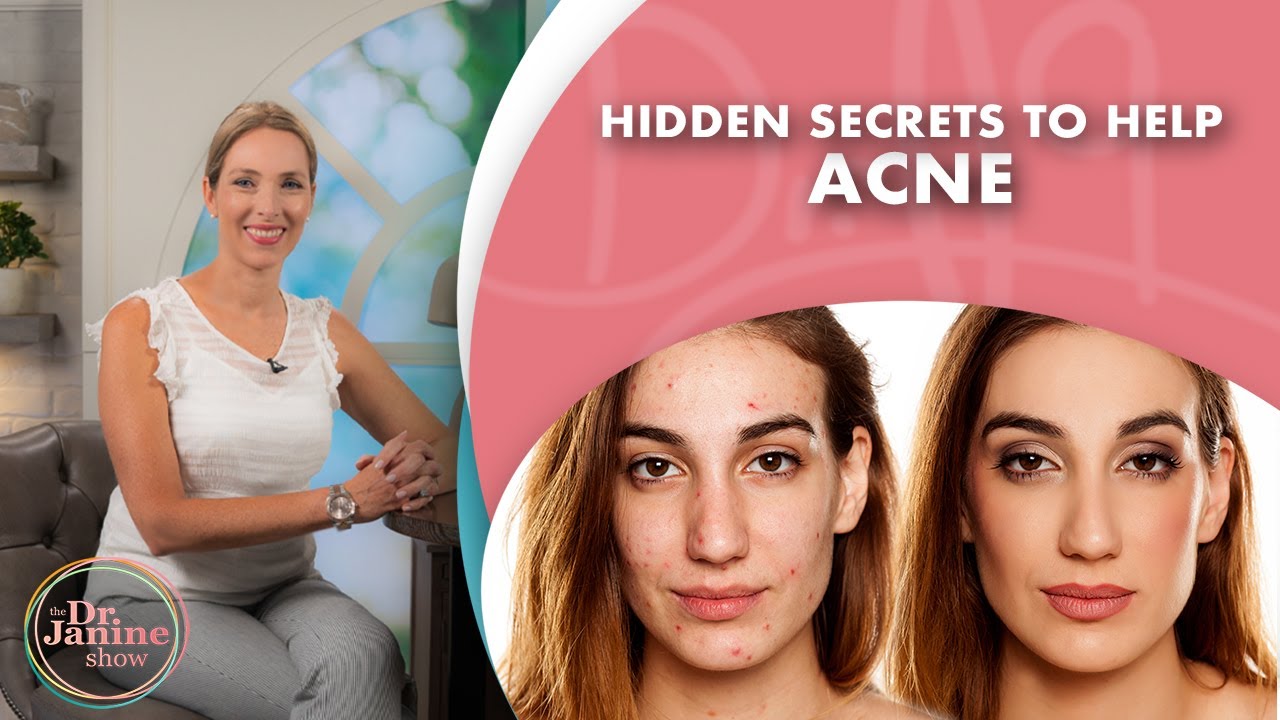 Hidden Secrets to Get Rid of Acne Naturally : Episode 13 &ndash; DrJ9 live