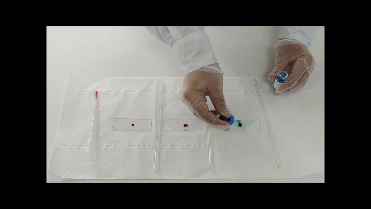 Προσδιορισμός ομάδων αίματος