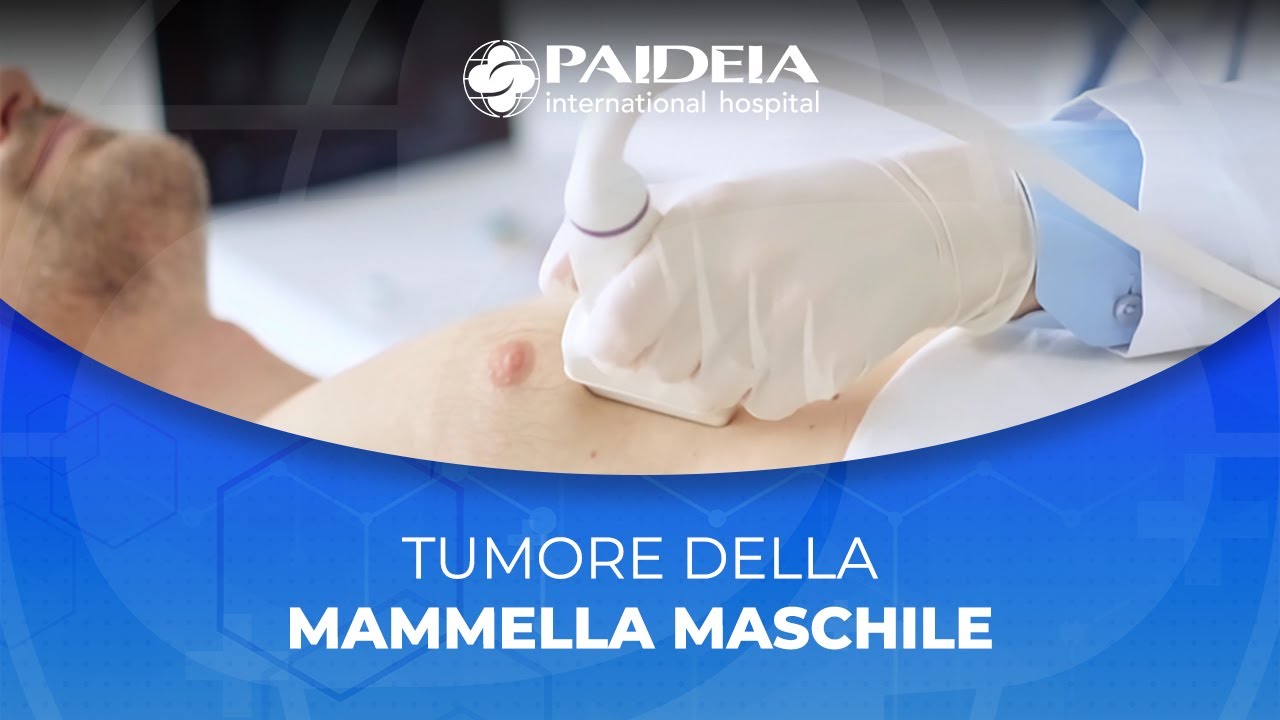 Tumore della mammella maschile