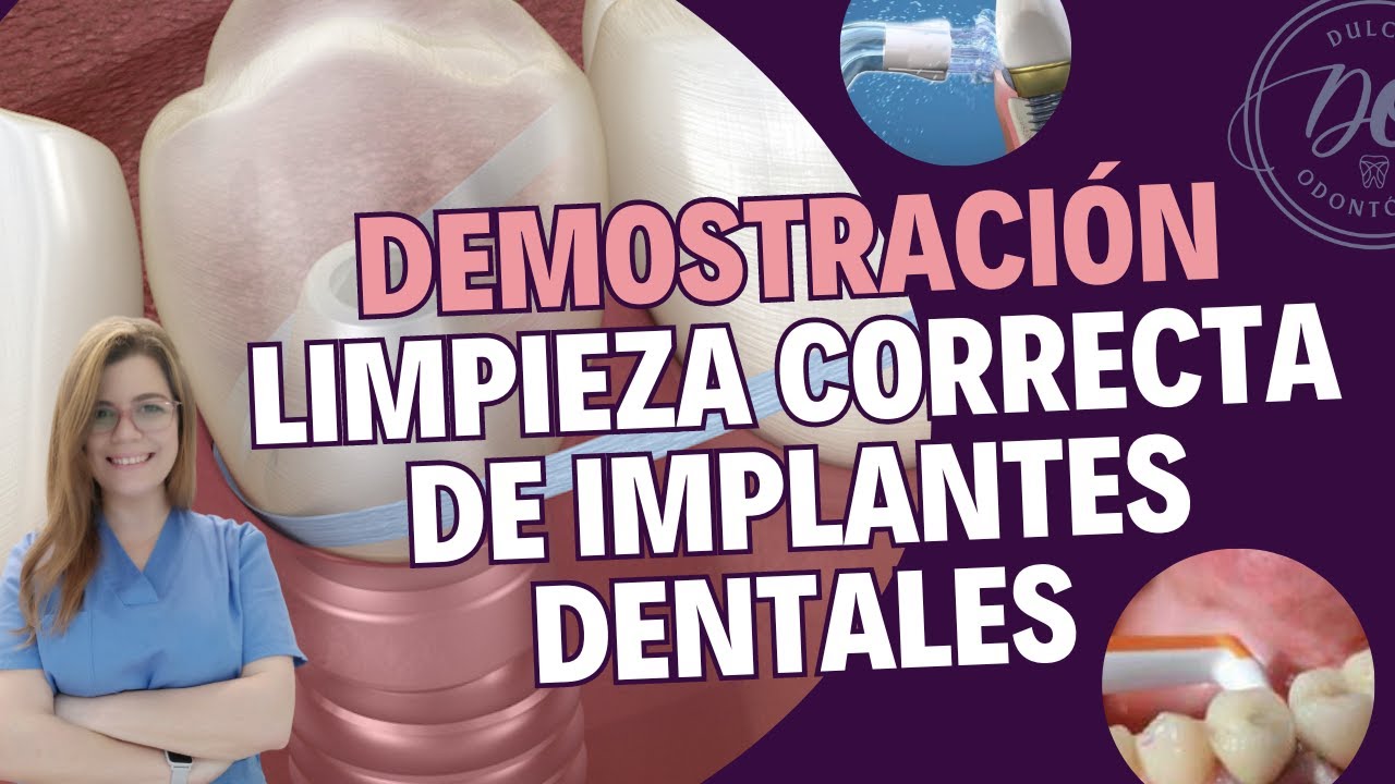 Como LIMPIAR los IMPLANTES DENTALES para mantenerlos SANOS !!! 🦷💦