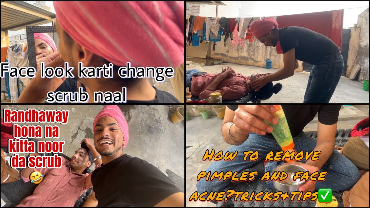 How to remove face acne ✅|Randhaway hona noor da scrub kitta🤣new telent Randhaway da ayiya sahmne