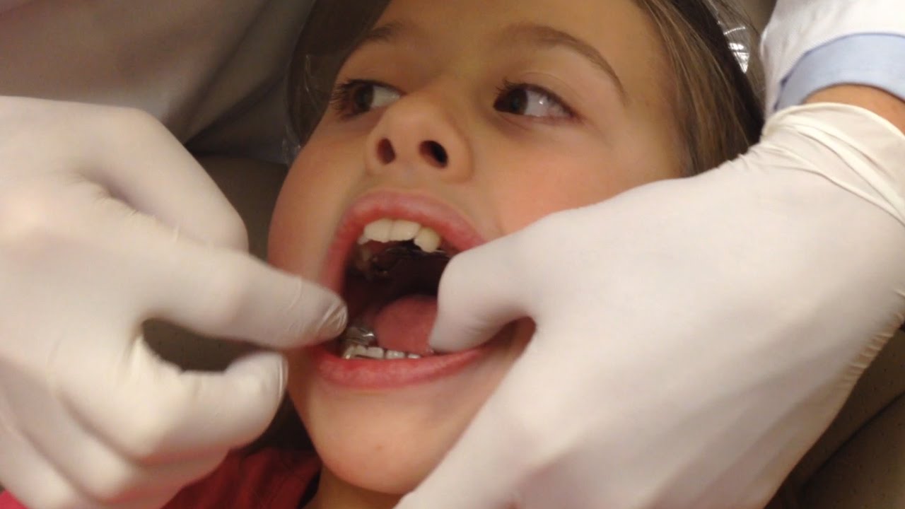 GABRIELLE GETS BRACES | EPISODE 6