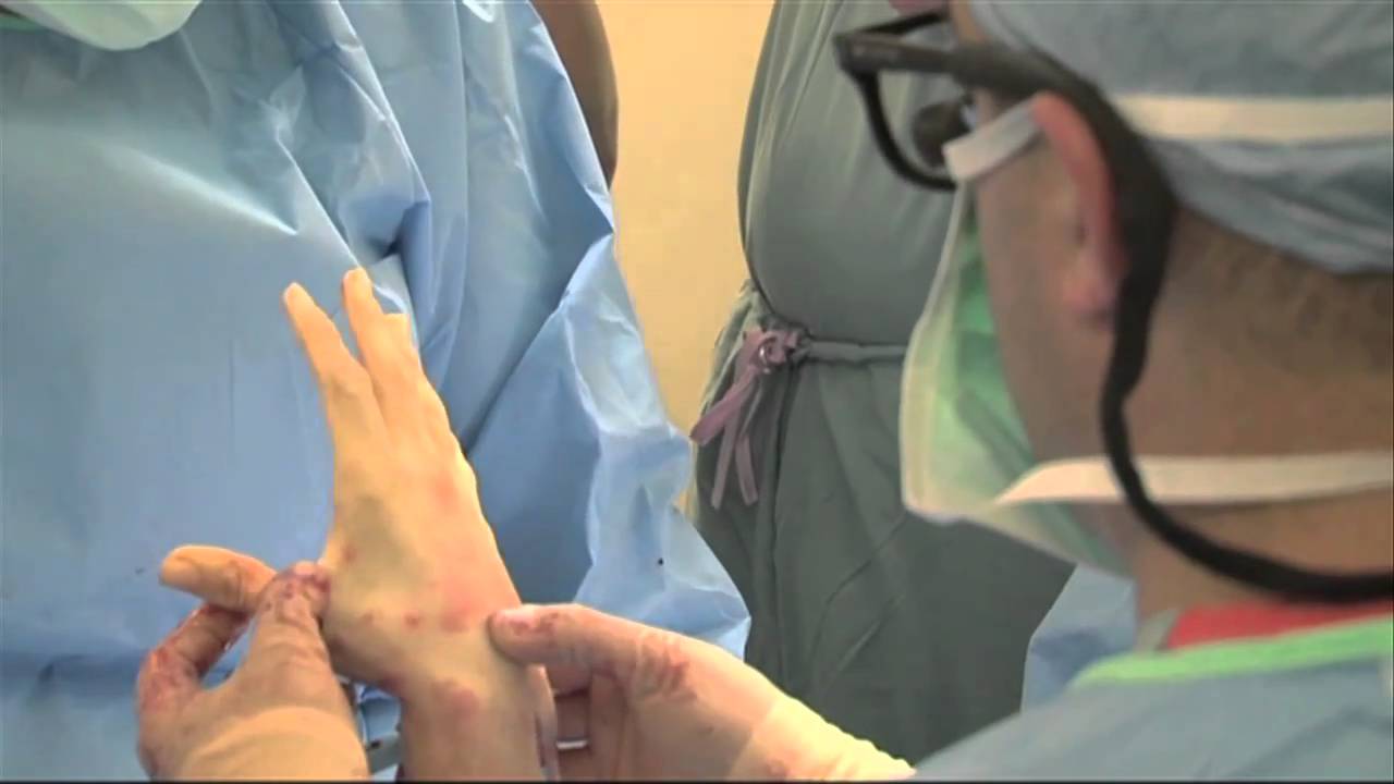 UCLA Hand Transplant Surgery