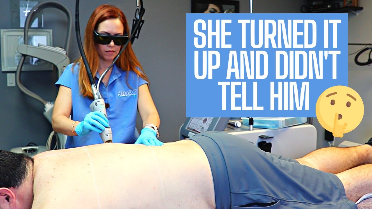 THIRD SESSION OF BACK LASER HAIR REMOVAL