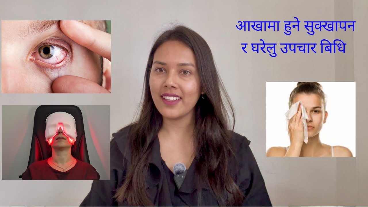 आँखामा हुने सुक्खापन र घरेलु उपचार बिधि | #nepalieyedoctor #dryeyes