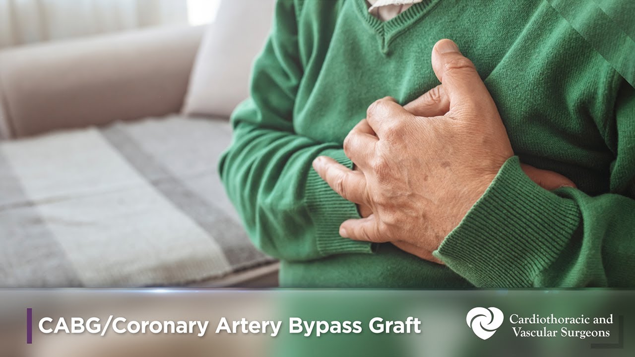 Coronary Artery Bypass Grafting | CABG | Cardiothoracic Surgery | CTVS Texas