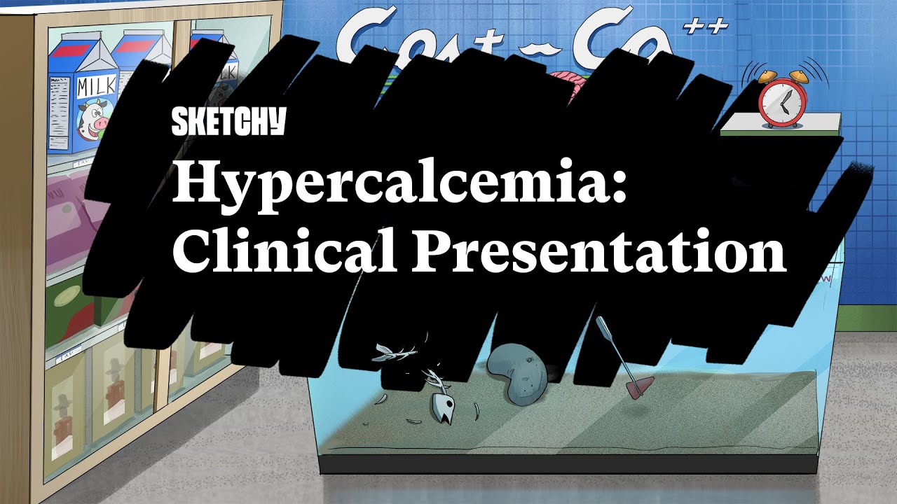 Hypercalcemia Lesson (Clinical Presentation) Part 1 | Sketchy Medical | USMLE Step 2 CK