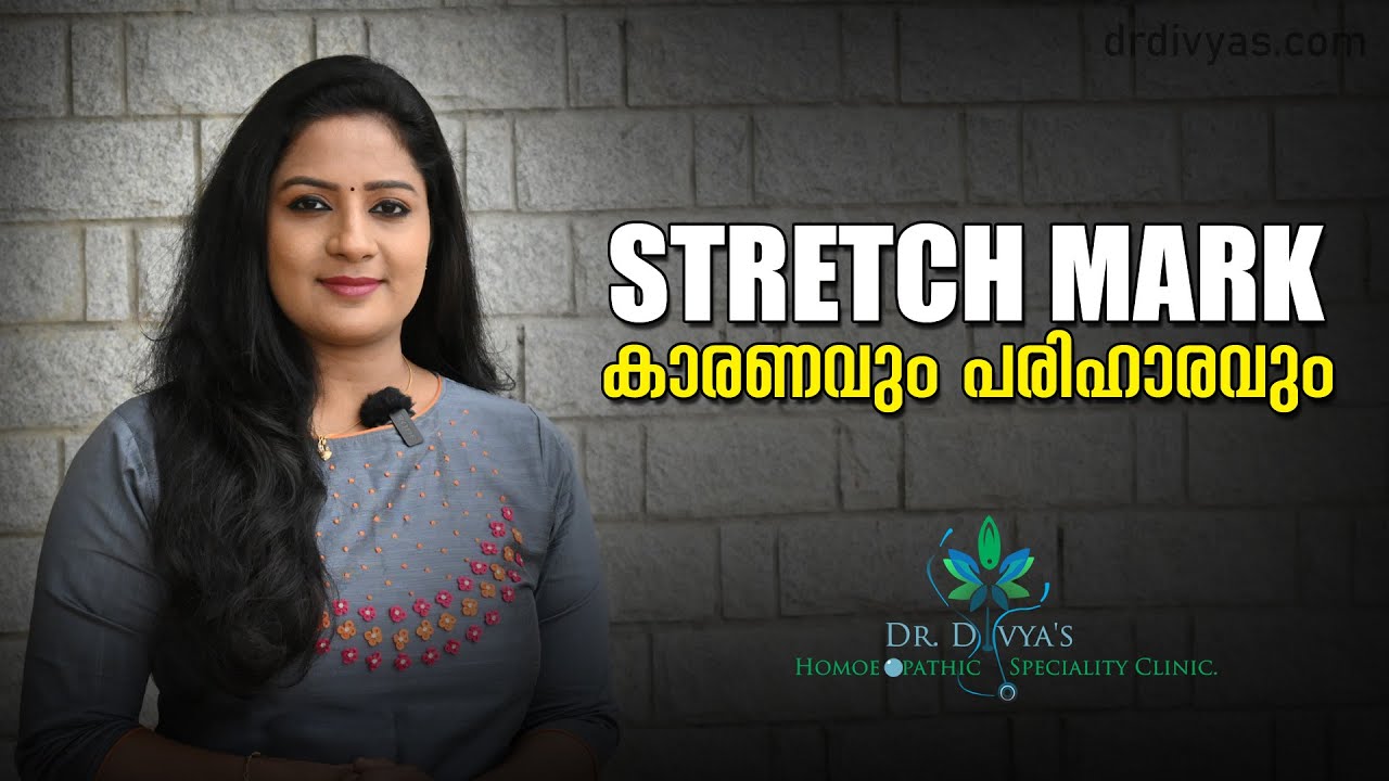 STRETCH MARK കാരണവും പരിഹാരവും | How to Remove Stretch Marks | How to Remove Scars | Dr. Divyanair