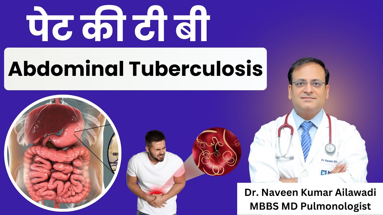 Abdominal Tuberculosis | पेट की टी बी | Symptoms and Treatment | Intestinal TB | Dr. Naveen Ailawadi