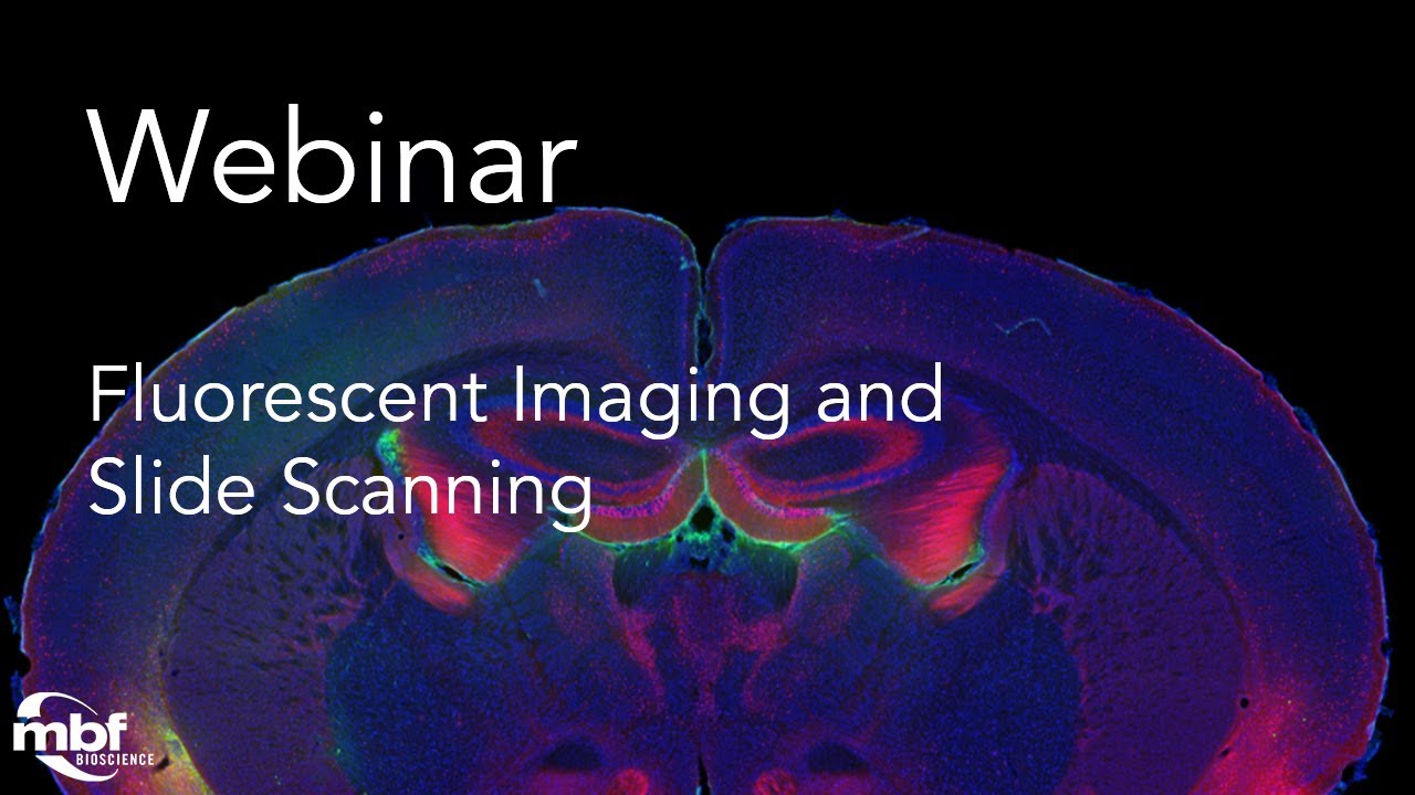 Webinar: Fluorescent Imaging and Slide Scanning – Techniques and Best Practice