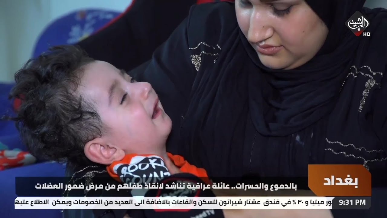 بالدموع والحسرات.. عائلة عراقية تناشد لانقاذ طفلهم من مرض ضمور العضلات