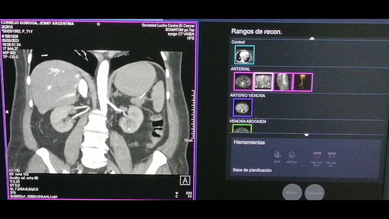 APLICACIONES PARA TOMOGRAFIA GO