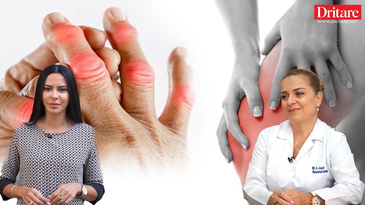 Armiku i kockave në dimër/Shpëto nga reumatizma! | Dritarja e Doktorit (16.09.2022)
