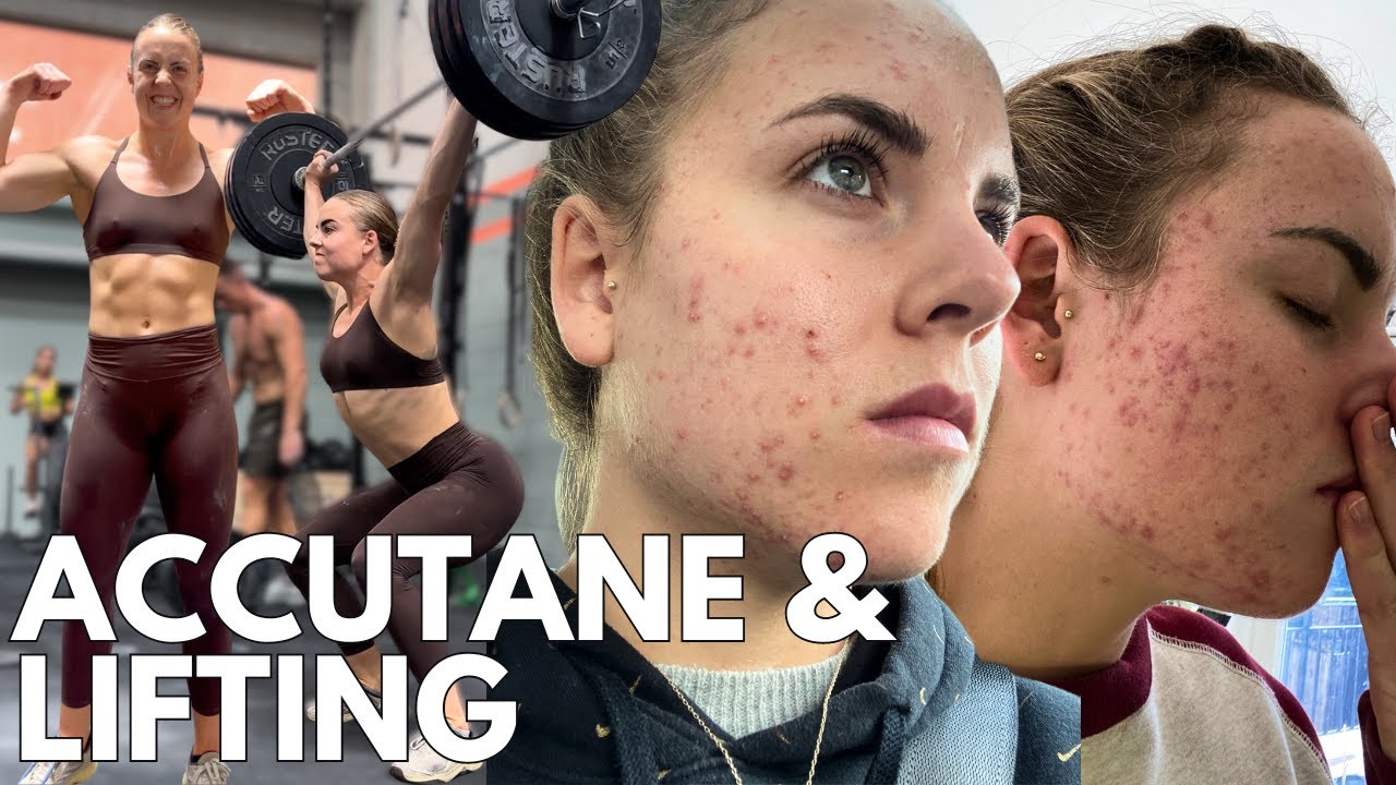 WEIGHTLIFTING & ROACCUTANE | Joint pain, muscle soreness, strength & weightloss?