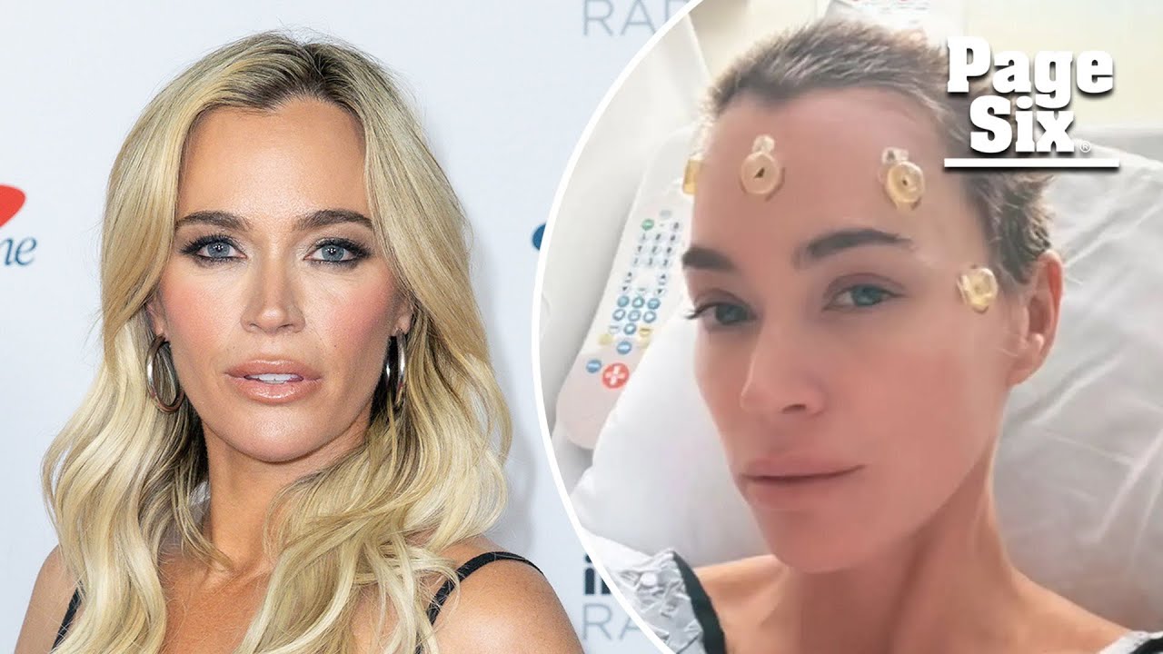 Teddi Mellencamp shares symptoms that led to brain tumor discovery in ABC News interview