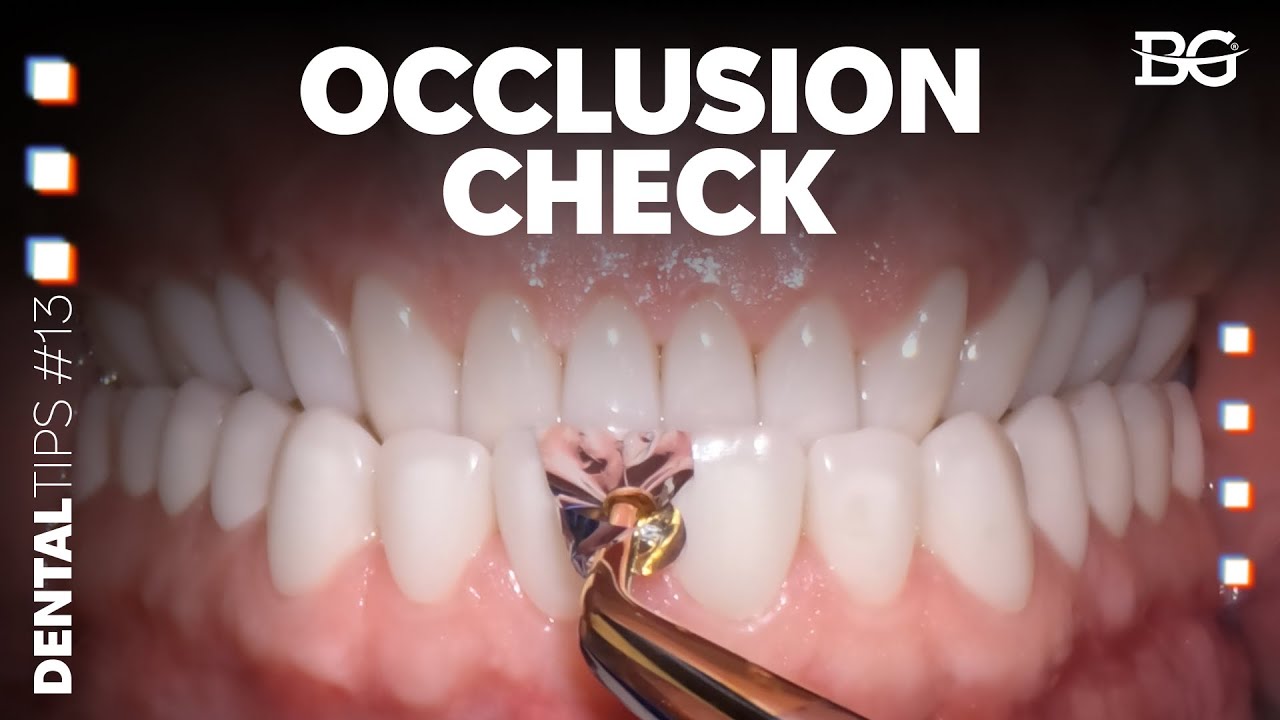 Full mouth rehabilitation: occlusion check