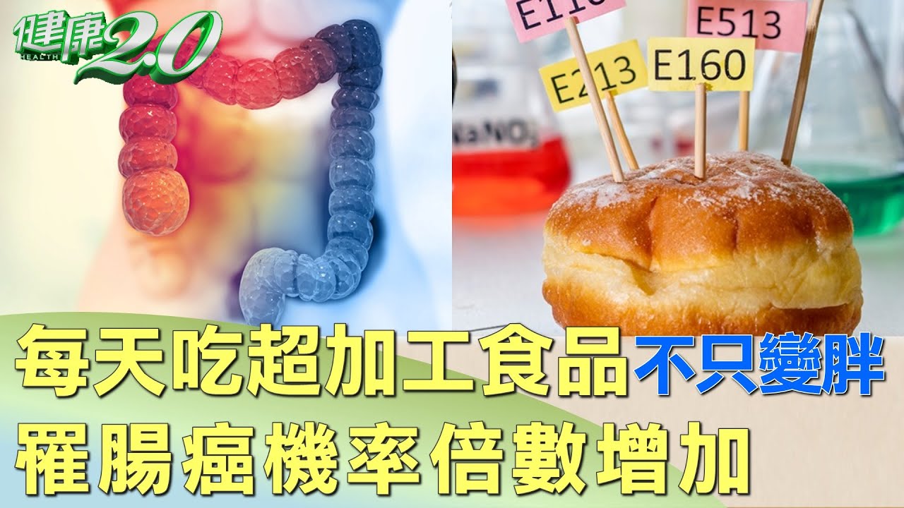 每天都吃超加工食品不只變胖 罹腸癌機率倍數增加 健康2.0