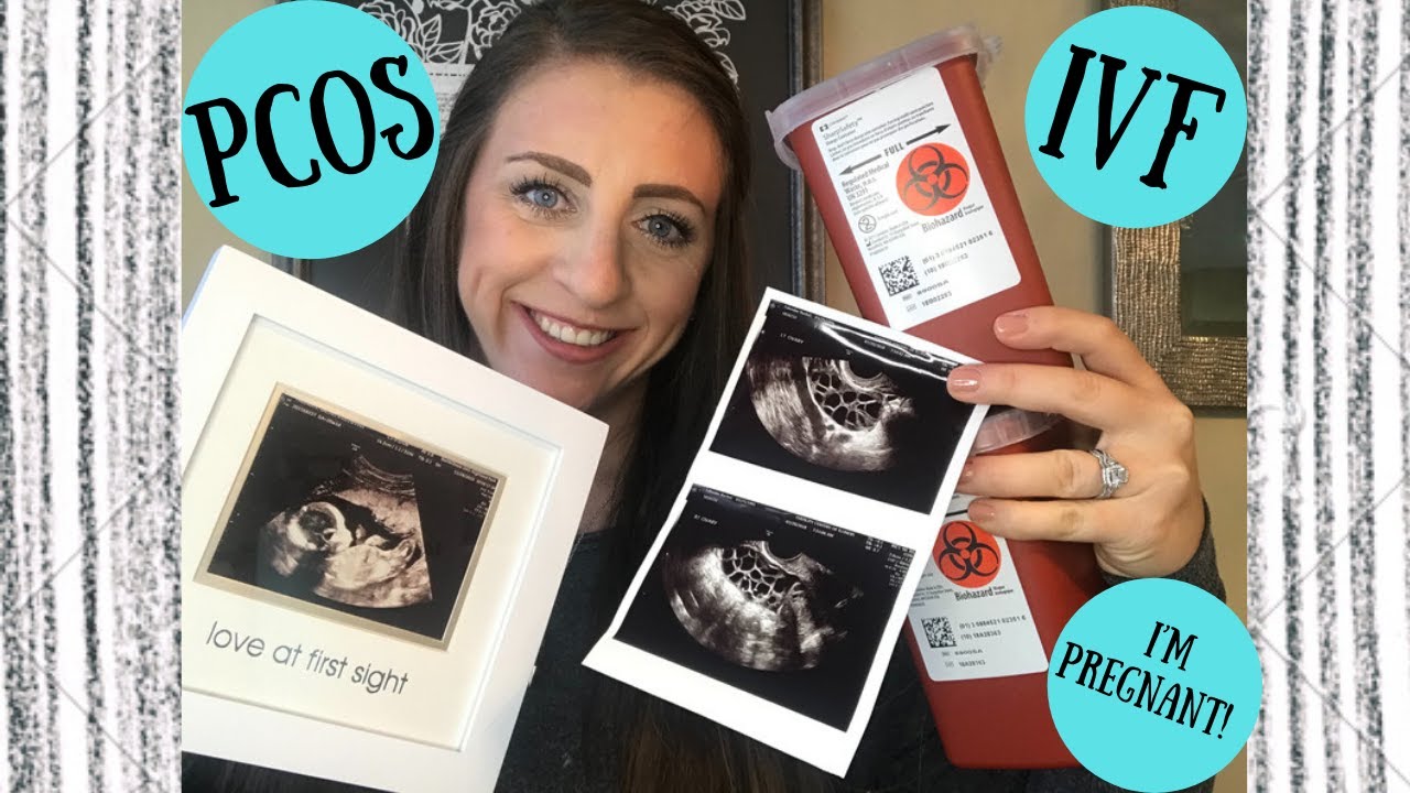 Rachel's Fertility Journey - Part 1 | PCOS | IVF