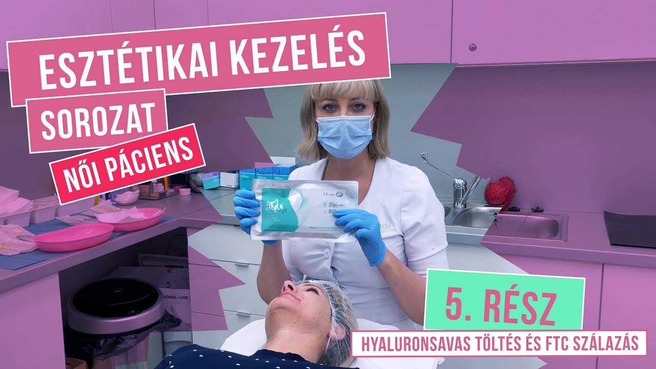 HYALURONSAVAS TÖLTÉS ÉS FTC SZÁLAZÁS - ESZTÉTIKAI KEZELÉS SOROZAT NŐI PÁCIENSEN (Dóri, 40) – 5. RÉSZ